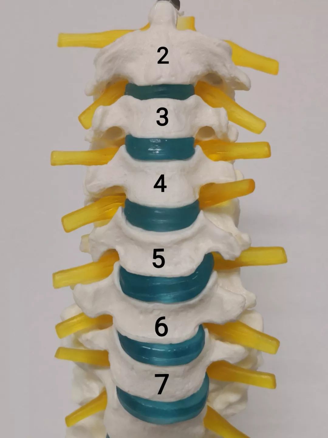 人體的頸椎有7節椎體組成,從第二節椎體開始,椎體與椎體之間有5個關節