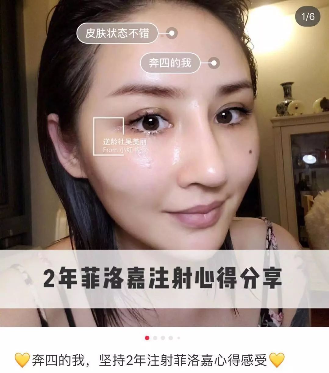 3000元的頂級水光針,它的醫美黑科技竟然都在這支精華里!_菲洛嘉