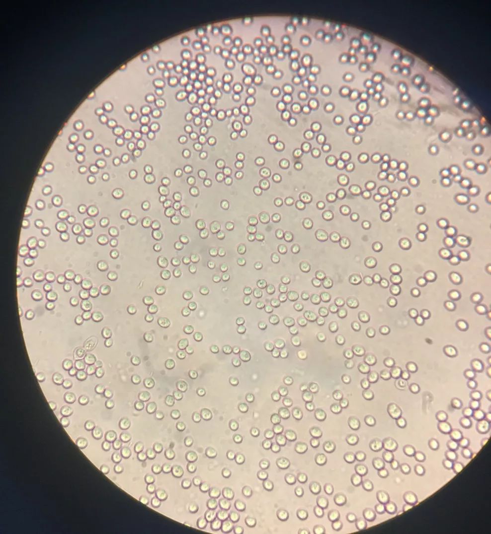 啤酒酵母显微镜下形态图片
