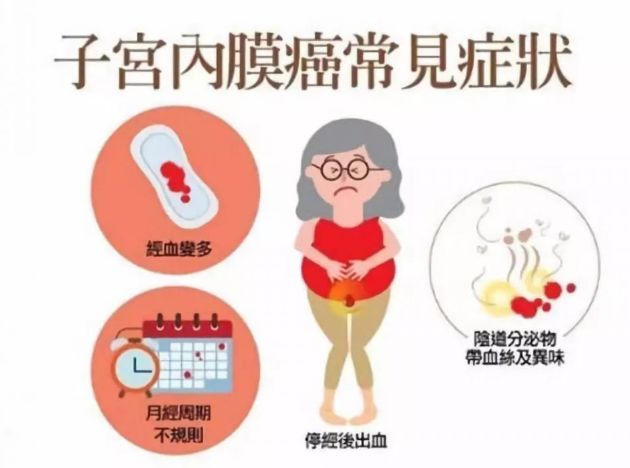 【人大评议专区·聚焦健康教育】如何正确预防子宫内膜癌?