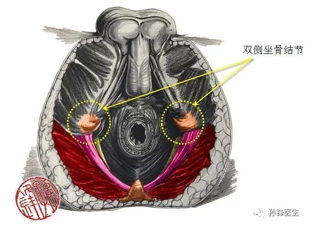 醫學筆記|男性會陰部的肌肉系統(中肛管水平):(上)_解剖