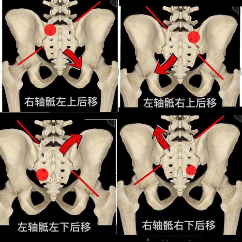 坐着起来就腰酸腰痛,行走时还好,究竟是怎么回事?