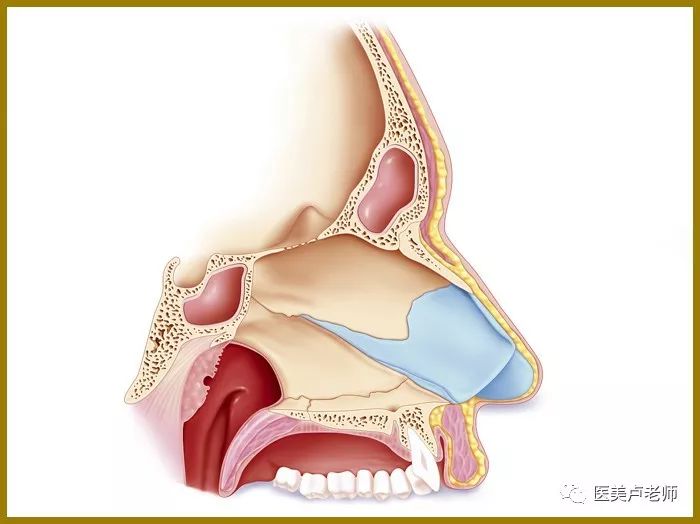 鼻中隔偏曲骨头图片