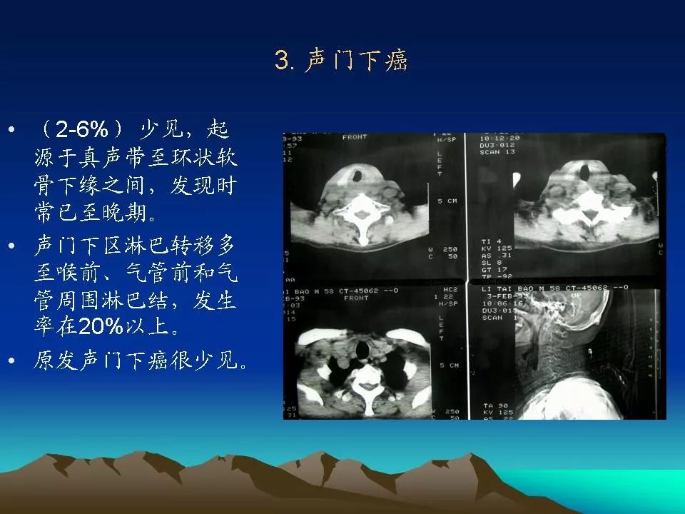 喉腔声门裂,声门裂_大山谷图库