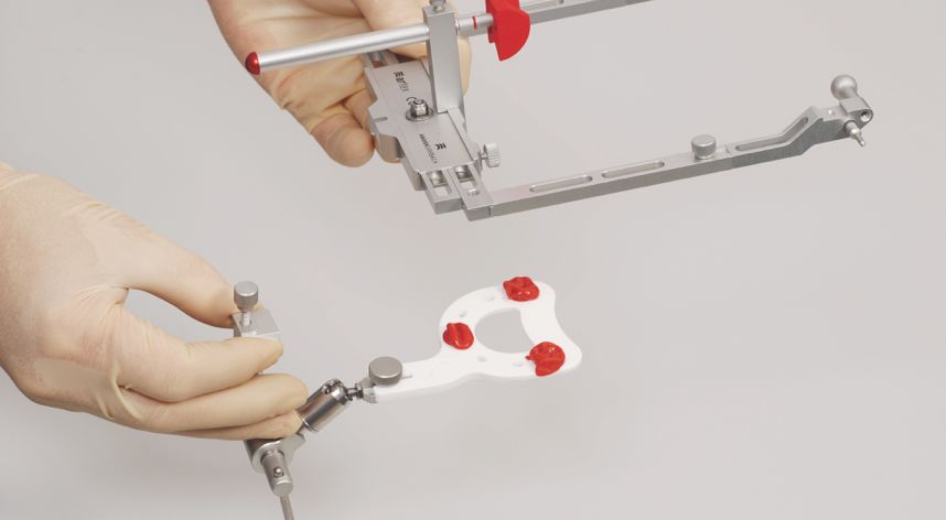 吉尔巴赫面弓及使用方法