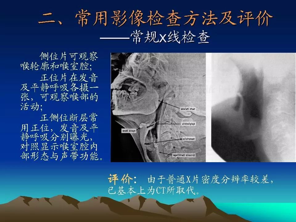 喉癌的ct,mri诊断 | 影像天地_栏目