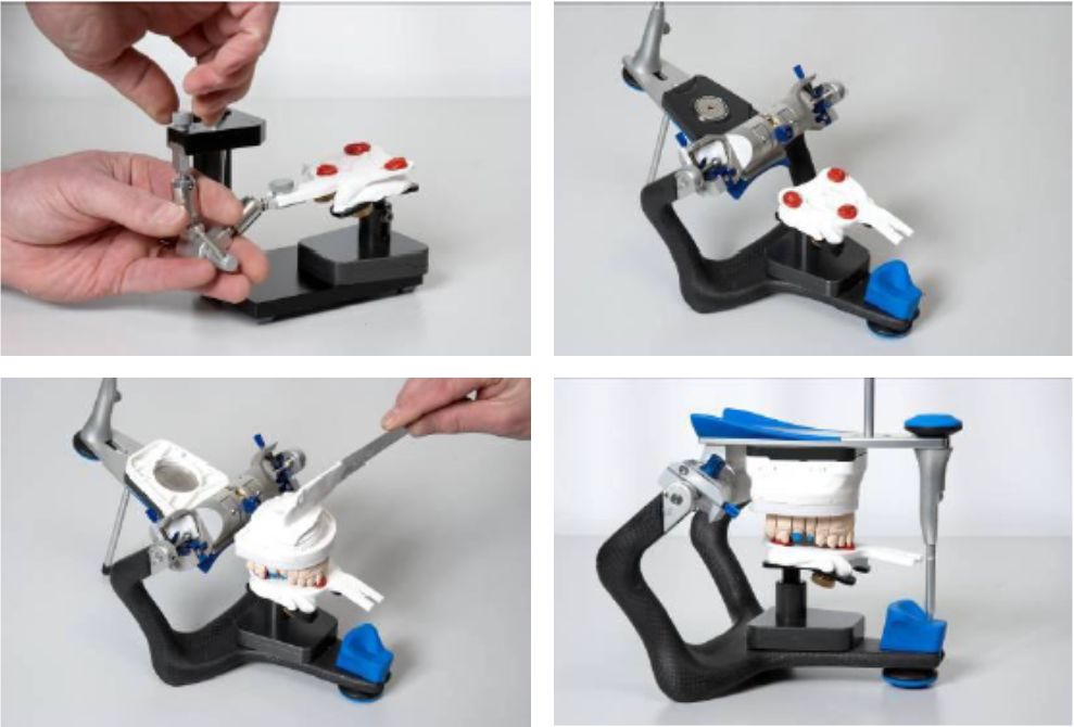 吉尔巴赫面弓及使用方法