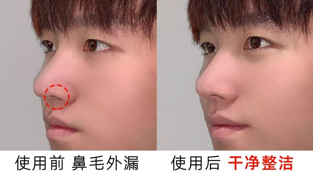 一根鼻毛毁所有稳准狠的鼻毛断头台德国人每天都在用