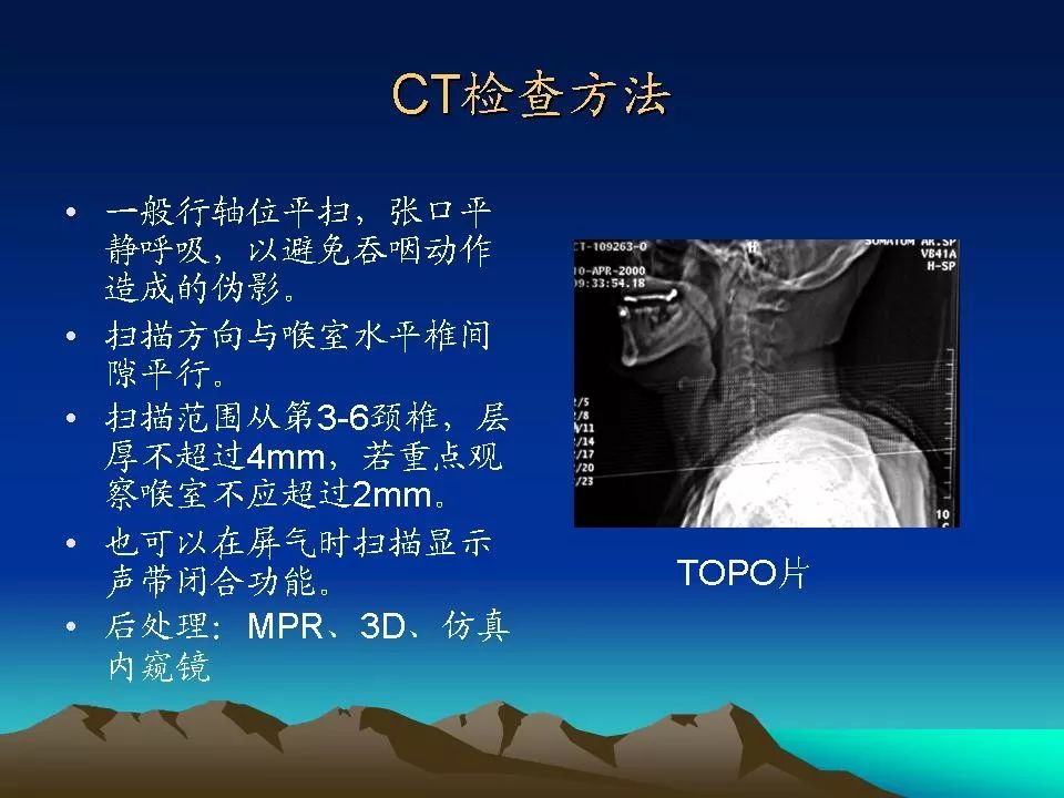 喉癌的ctmri诊断影像天地