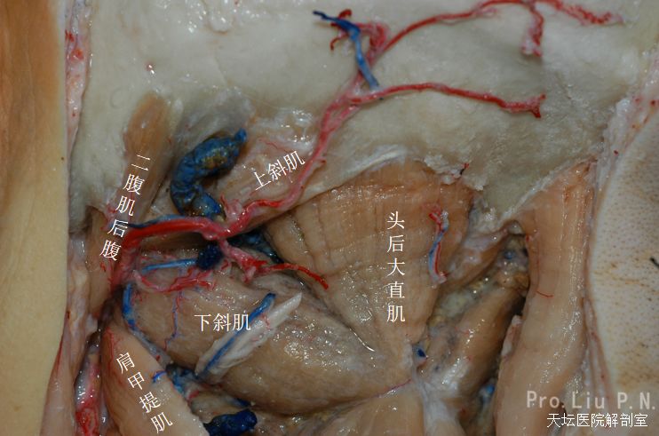 刘丕楠教授内镜和颅底外科团队远外侧入路不同切口的临床应用