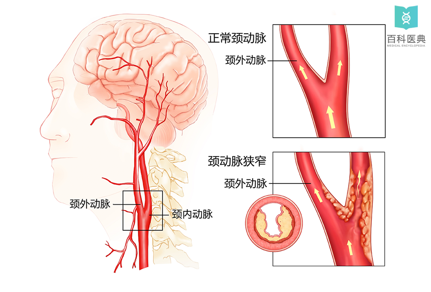 颈外动脉及其分支图图片
