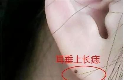 女人身上有这4颗痣最幸运注定是富婆年龄越大越富贵越老越有钱旺夫旺