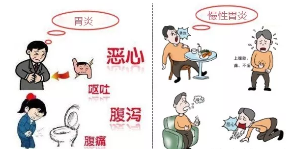 胃炎和慢性胃炎的区别有哪些?_症状