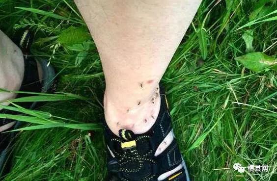 看到这种虫,千万别用手拍!已有网友挨了