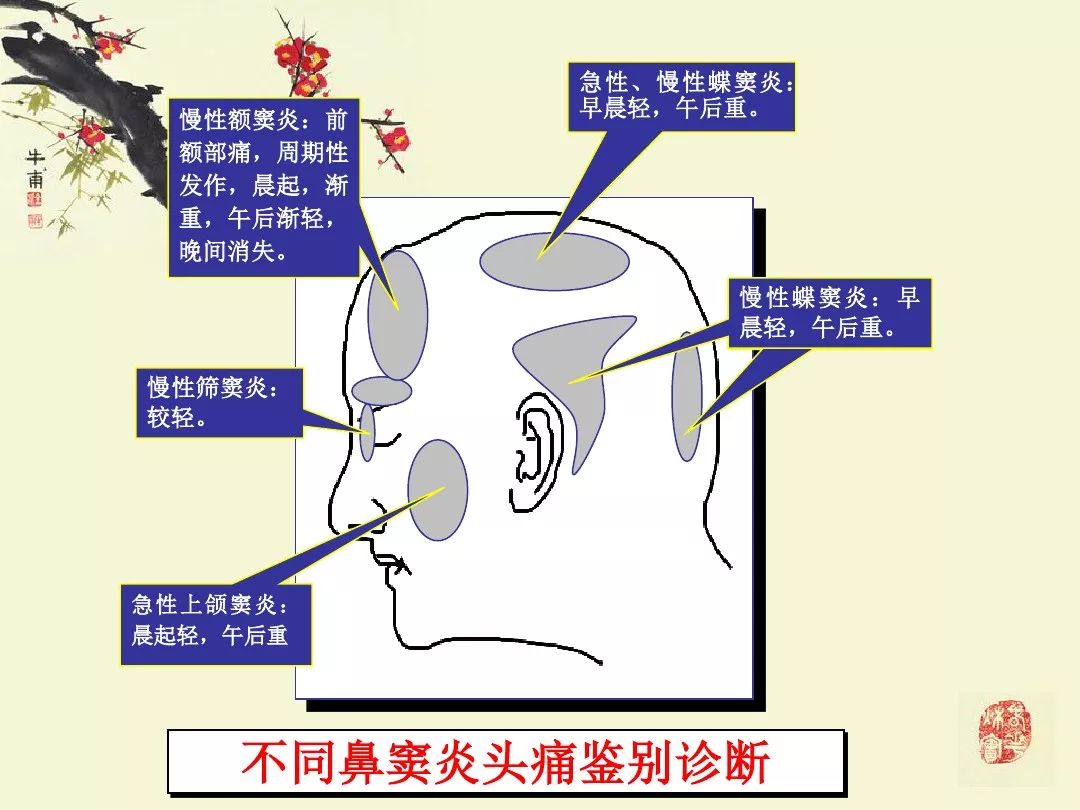 鼻鼻竇炎的影像學表現