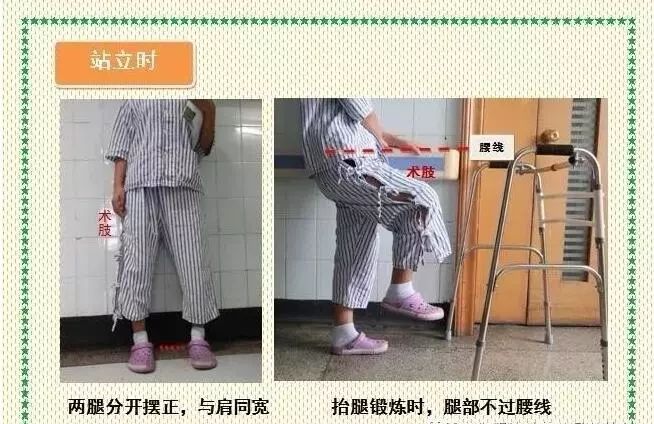 夏邑二院骨科:股骨头坏死及髋关节置换的应用