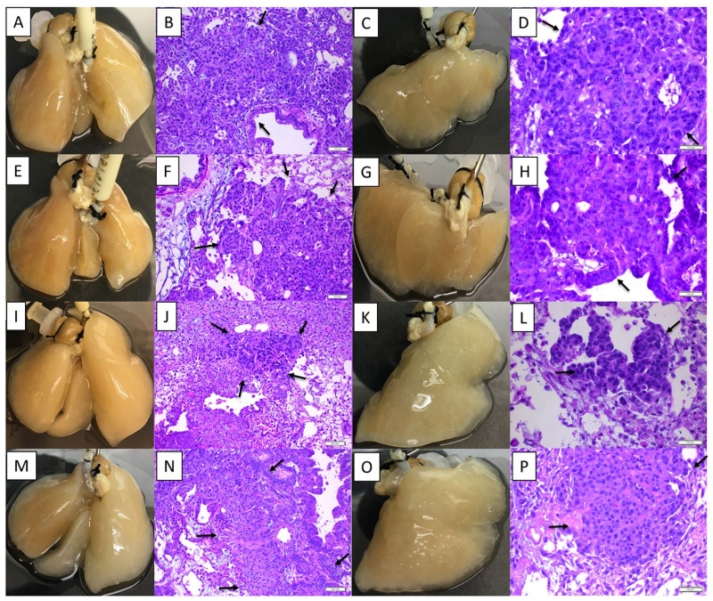 肿瘤的免疫细胞疗法