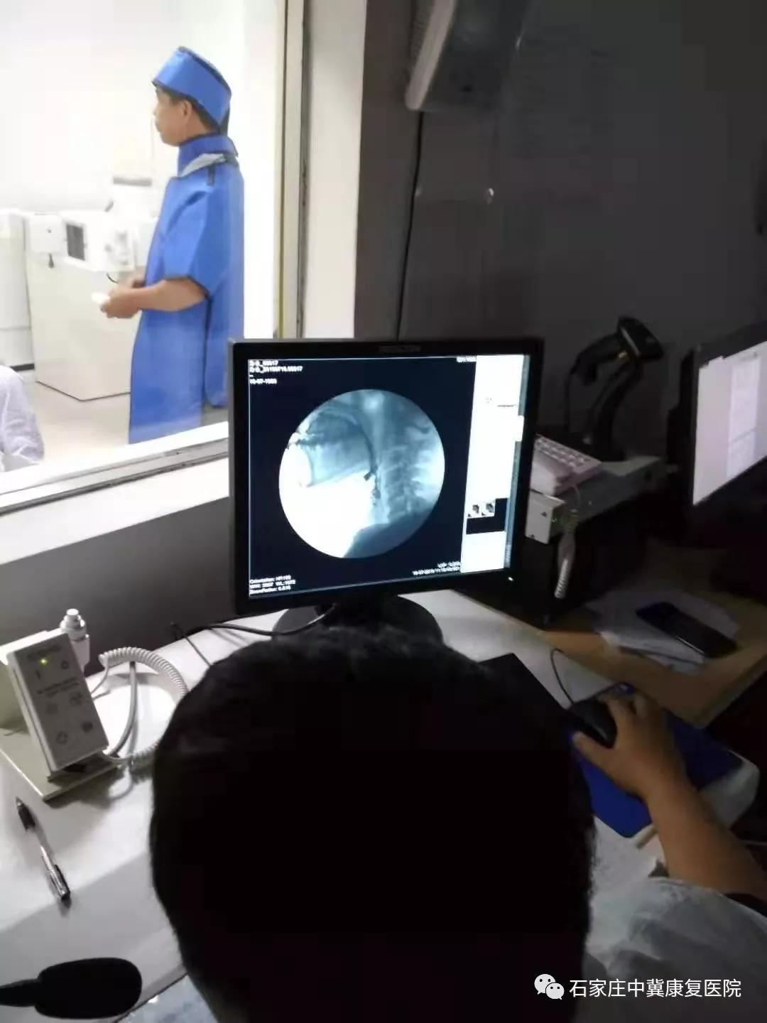 吞咽造影吞咽障碍诊断的金标准