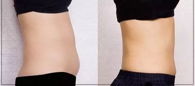 口腔里的这个杀手一定要注意轻者口臭重者胃癌