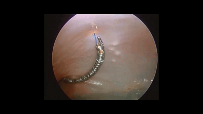 看到这根魔性的东西我觉得黄鳝快失业了