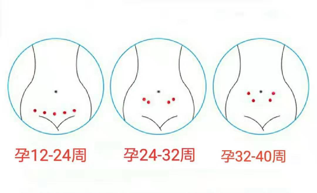 胎心率高低暗示性别深度解锁胎心率小秘密孕妈早了解早防范