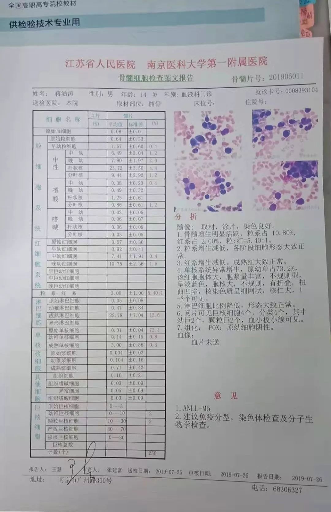 在7月27日被确诊为急性单核细胞白血病,需做异基因造血干细胞移植手术