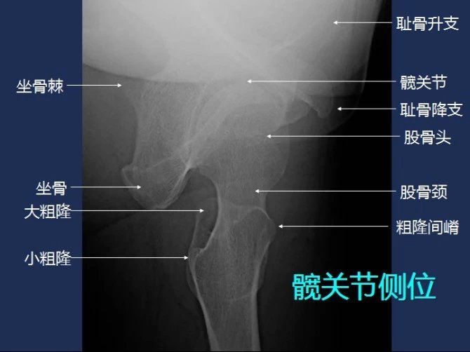 常规x线影像解剖大全