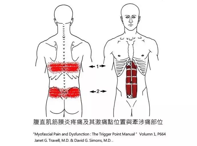 腰肌劳损压痛点图片