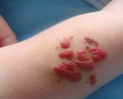 济南血管瘤医院：守护孩子健康的灯火