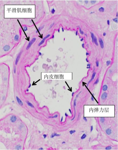 腎組織病理切片中,小動脈並不難辨識,入球和出球小動脈可以根據腎小球