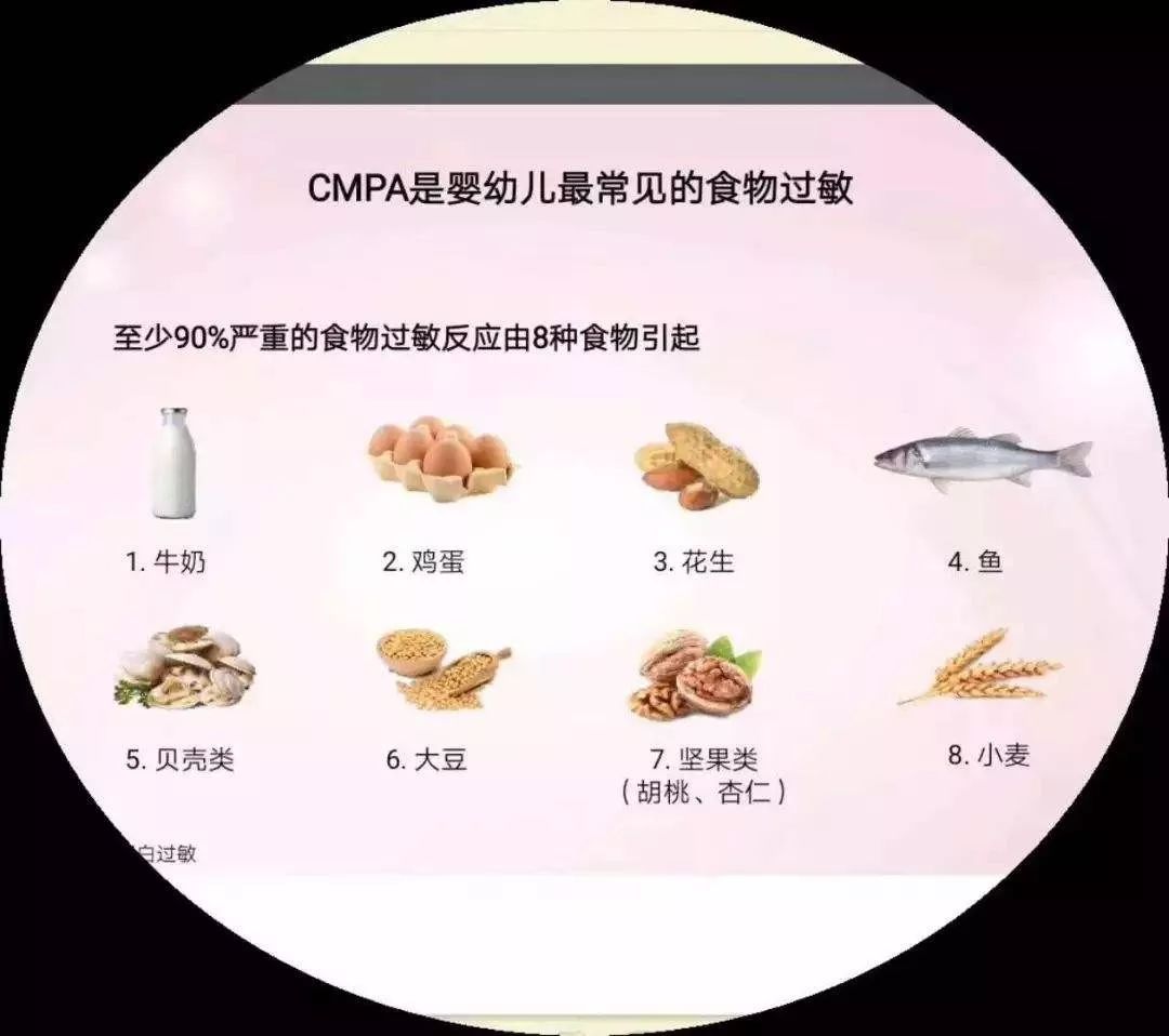 食物过敏这3个真相你和孩子都要知道