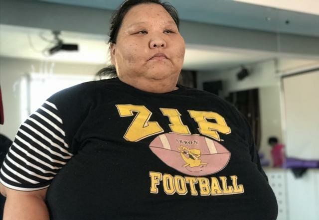 400斤女孩,每天做这几个运动,5年后减肥成功_都来