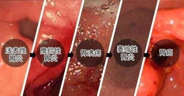 全方位还原虐胃大法