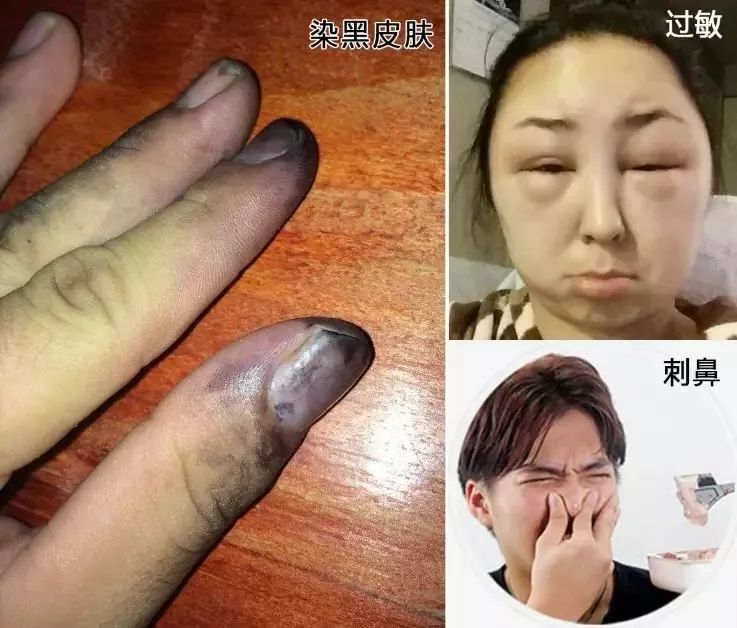 黑芝麻撒一把它,彻底告别白发,发量暴增2倍!_头发