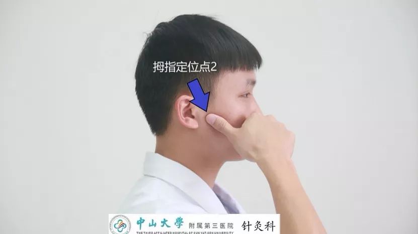 歪嘴面瘫,常规治疗外,这些在家就能做康复操,穴位按摩操也有帮助