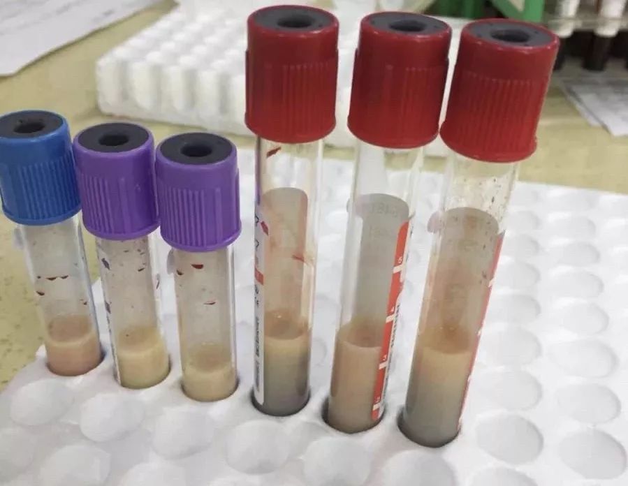 医学科就诊,急诊科医生进行问诊和体格检查后,给小虎开了抽血的检验单