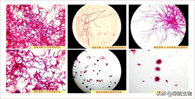 巨大芽孢杆菌形态图图片