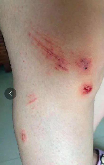 疯了安徽一漂流景区发生翻船事故千人打架哄抢皮划艇场面太混乱