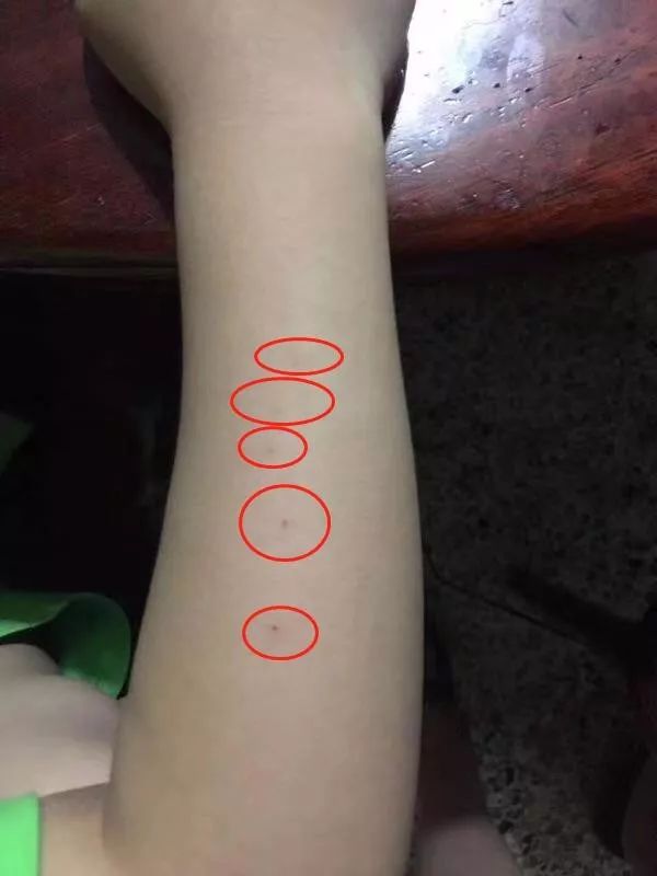 恶性潮州发生一起幼儿园保育员针扎幼儿事件官方发布情况通报