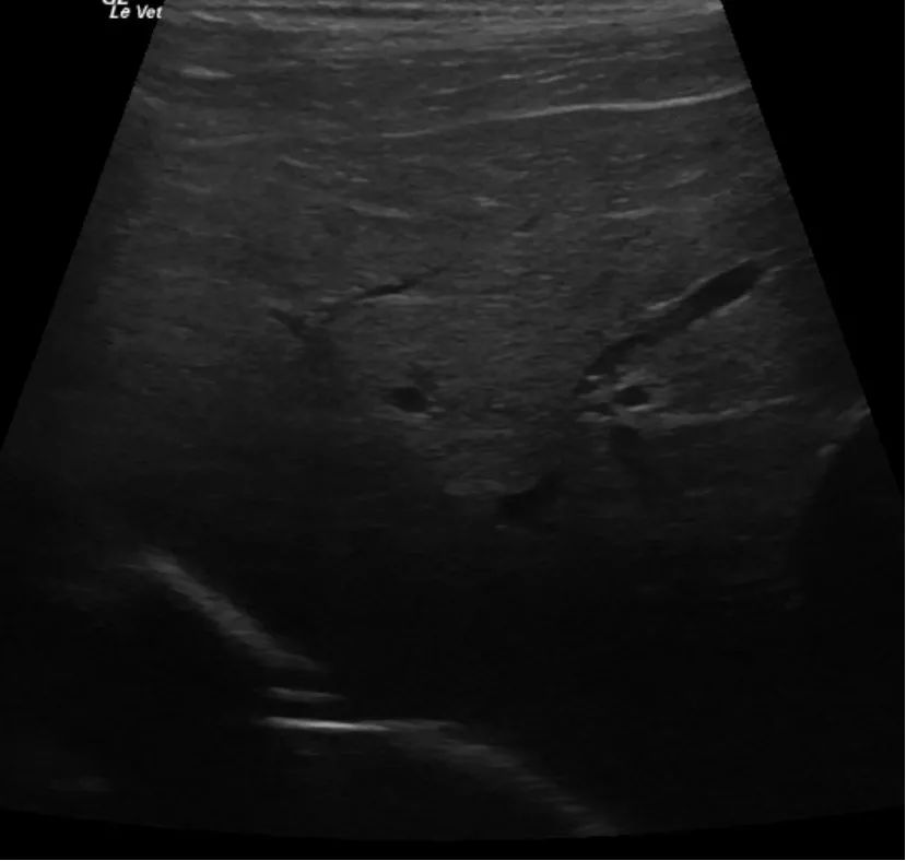 肝臟疾病的影像診斷_超聲