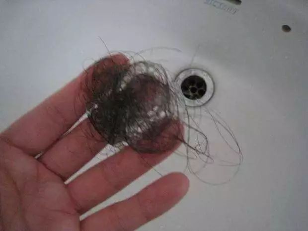 三甲医院毛发专家研发,国家专利加持的洗发水,脱发党有救了_头发