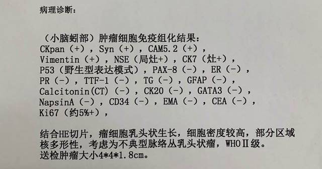 術後第三天mri增強:腦腫瘤全切除,腦積水消失.