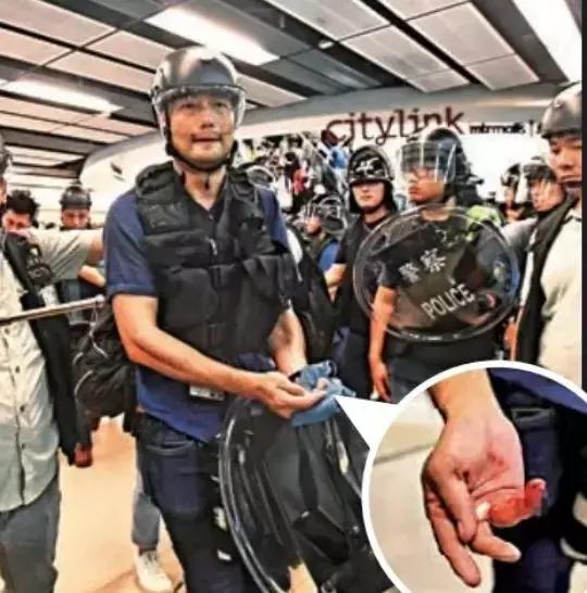 昨日香港警察宣布逮捕49名黄尸揭秘肛毒为什么被称为黄尸