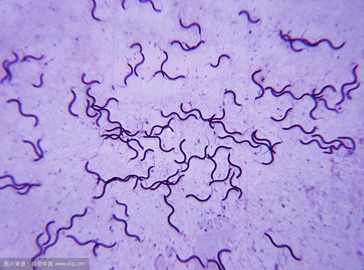 口腔细菌显微镜