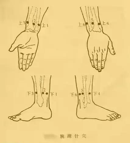 本疗法是把病症表现的部位归纳在身体两侧的6个纵区,在两侧的腕部和踝