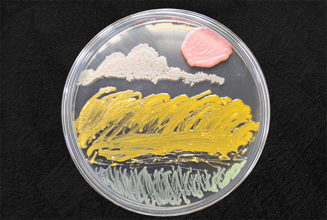 所有人关注第三届微生物培养皿艺术大赛赛况200多幅参赛作品已入围