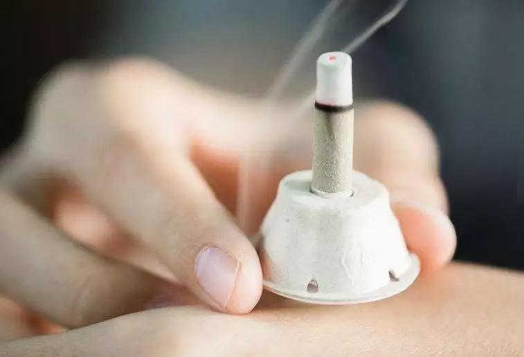 喜艾堂提醒灸出水泡居然还是好现象先分清灸花和烫伤