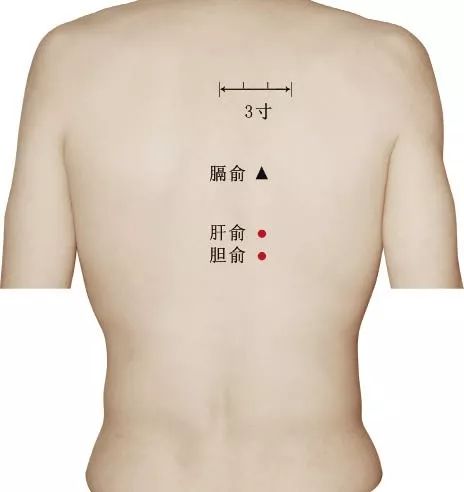肝俞束骨束骨具有疏通经脉,行气活血的作用;肝俞可以疏肝理气;脾俞