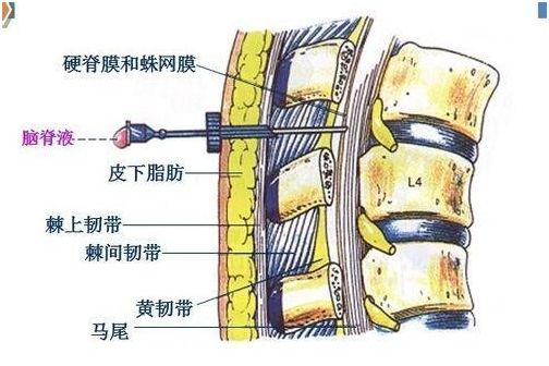 硬膜外麻醉解剖图图片