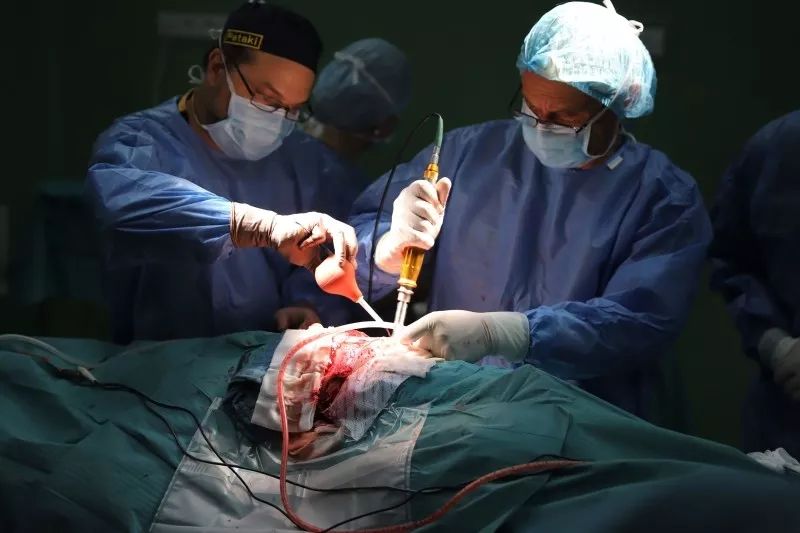 匈牙利医生30小时马拉松手术成功分离头部相连连体婴